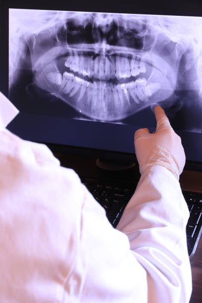 Best Emergency Dentist for Lost Fillings or Crowns in Jamestown, OH
