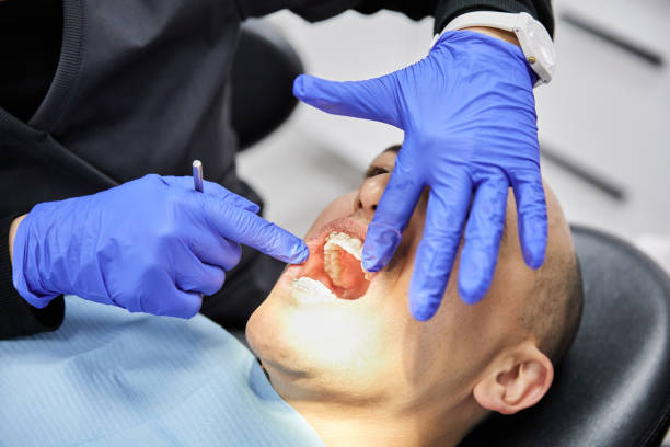 Best Emergency Dental Extractions in Jamestown, OH